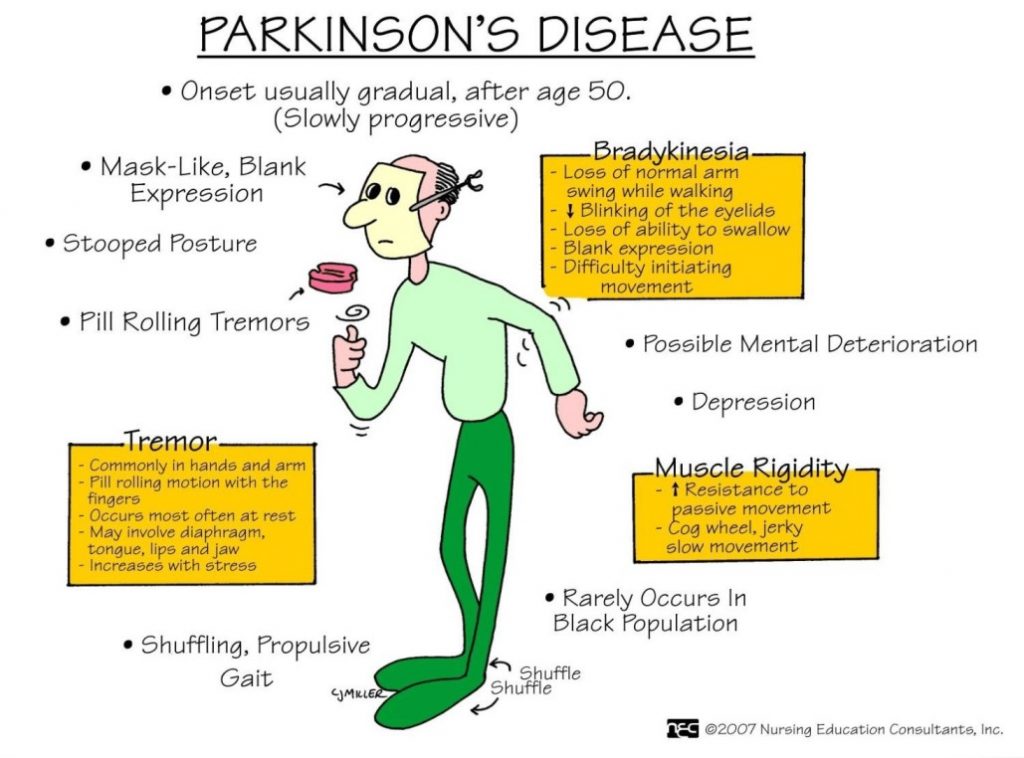 Symptoms of Parkinson's Disease (Antiparkinsonian Drugs)