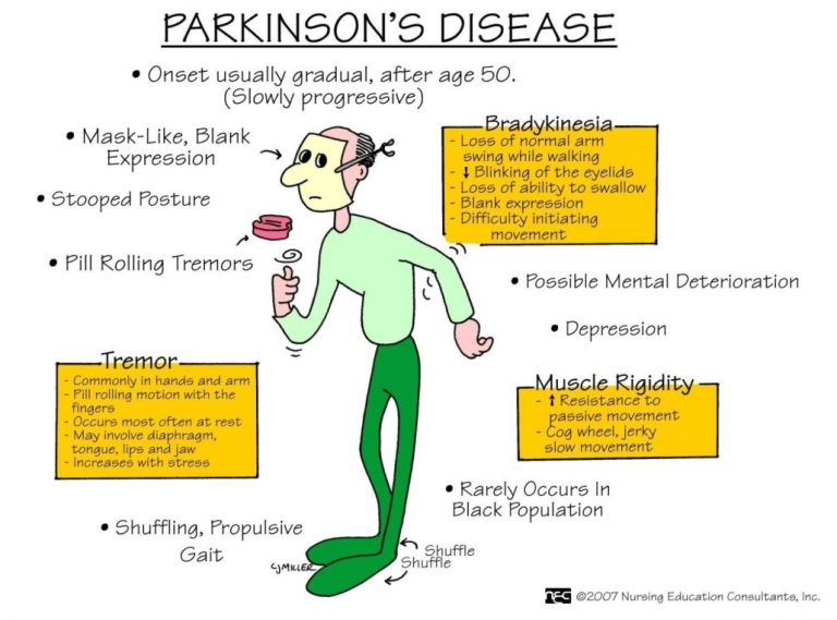 Antiparkinsonian Drugs Free Pharmacology Notes - 2021 - MyPharmaGuide.Com